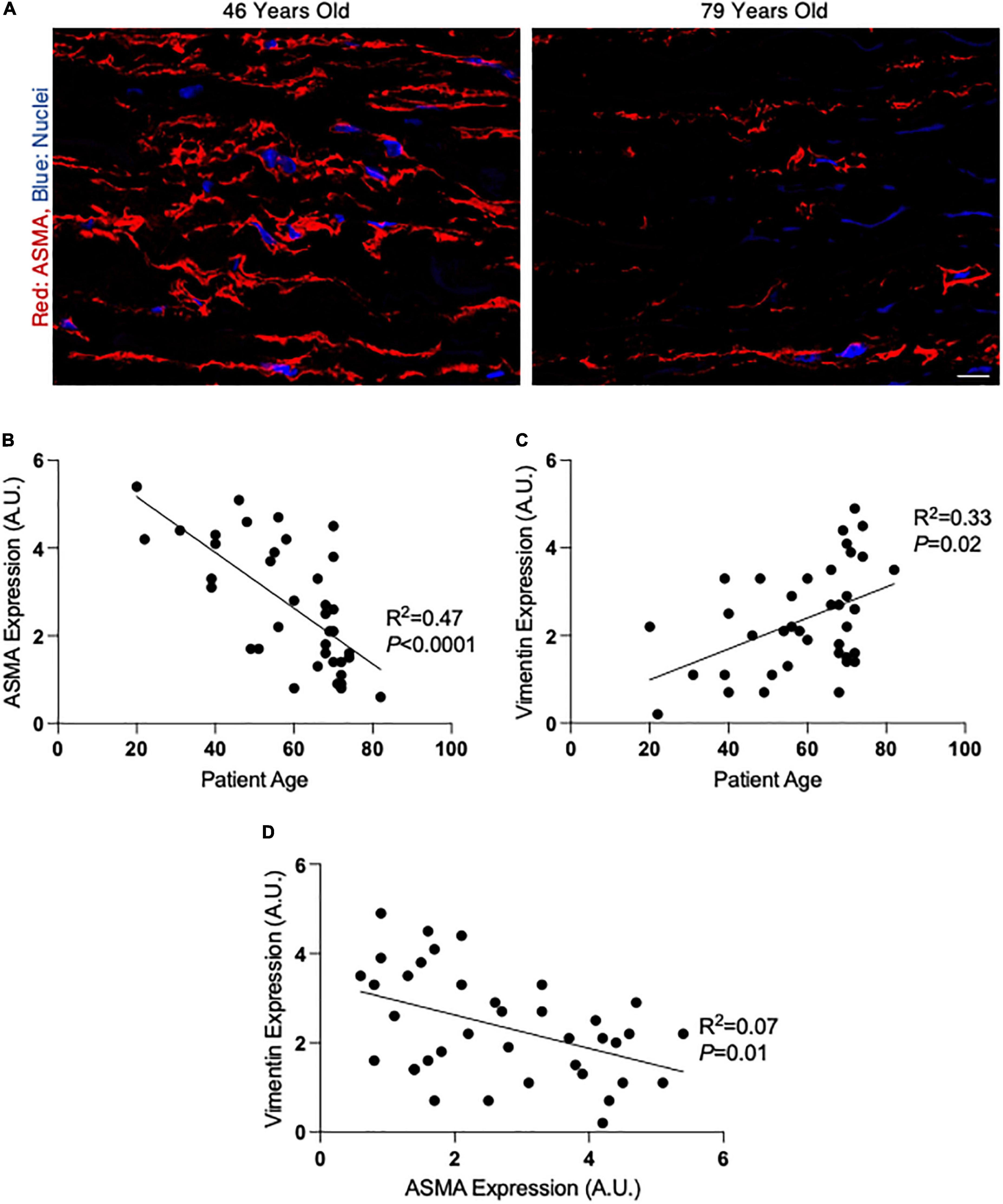 Age-dependent phenotypic modulation of smooth muscle cells in the normal ascending aorta